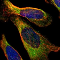 Muscle Phosphofructokinase/PFKM/PFK-1 Antibody, Novus Biologicals 0.1mL;